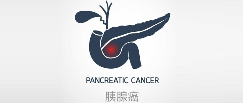 Pancreatic Cancer