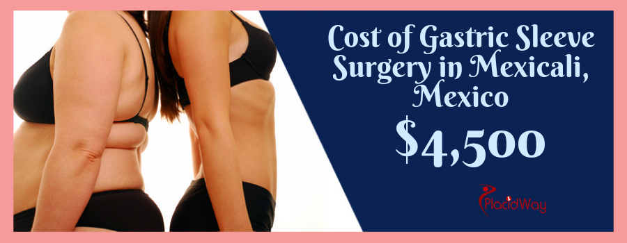 Gastric Sleeve Cost Mexico