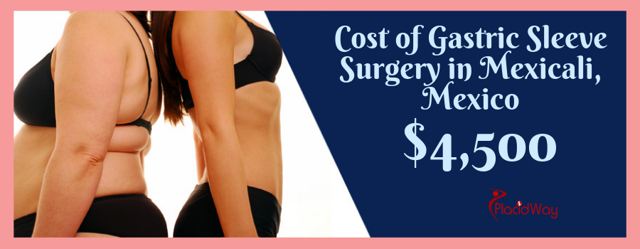 Gastric Sleeve Package in Mexicali Mexico Price