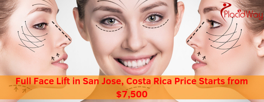 Full Face Lift in San Jose, Costa Rica Price