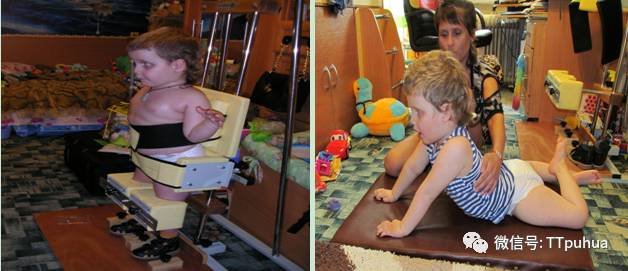 Cerebral Palsy Treatment at BPIH