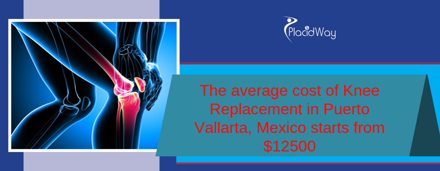 The average cost of Knee Replacement in Puerto Vallarta, Mexico starts from $12500