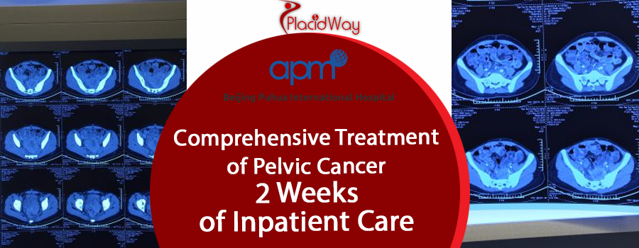 Comprehensive Treatment for Pelvic Cancer at BPIH, China