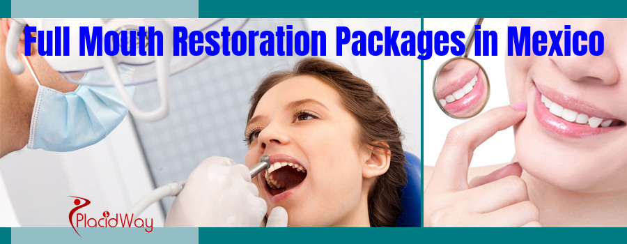 Get the Right One from the Best Full Mouth Restoration Packages in Mexico
