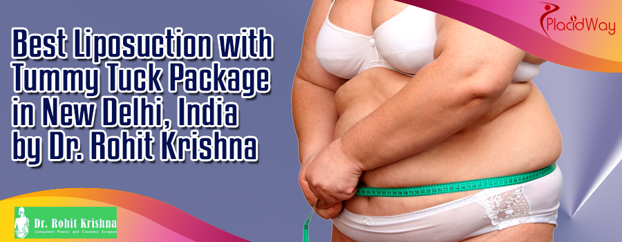Best Liposuction with Tummy Tuck Package in New Delhi, India by Dr. Rohit Krishna