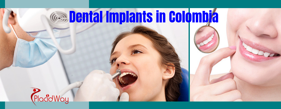 Dental Implants in Colombia