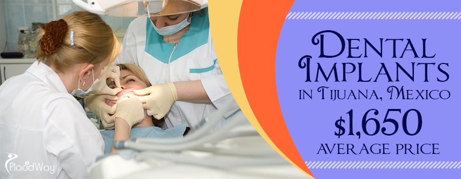 Best Dental Implant Package In Tijuana Mexico