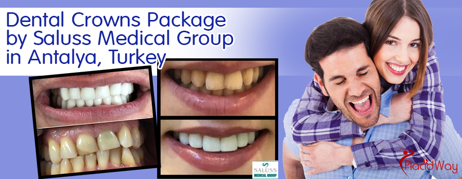 Dental-Crowns-Package-by-Saluss-Medical-Group-in-Antalya,-Turkey