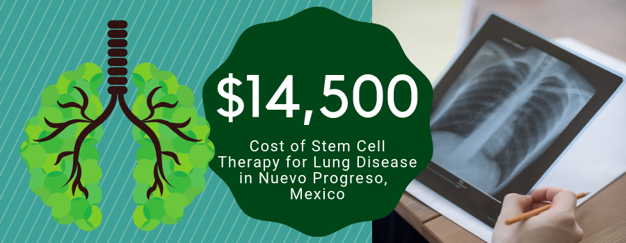 stem cell treatment cost stem cell treatment cost