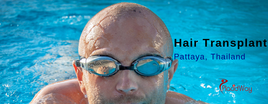 Hair Transplant In Pattaya Thailand