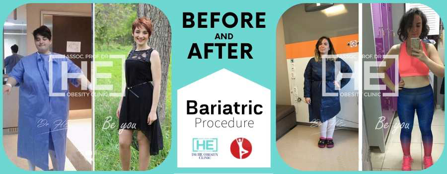 B & A Bariatric Surgery, Istanbul, Turkey