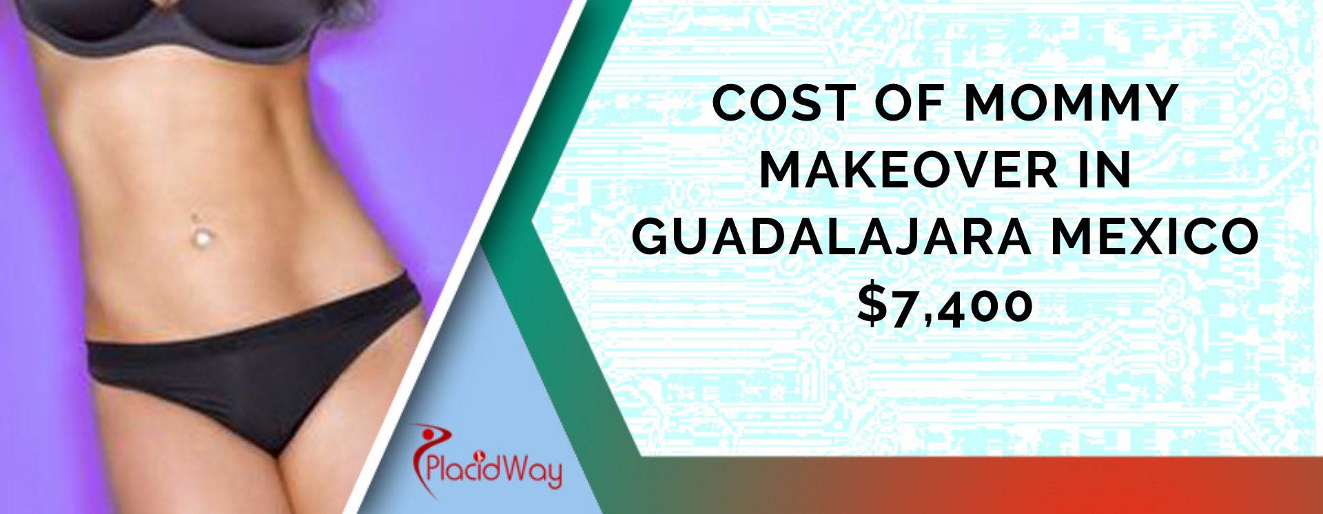Affordable Package for Mommy Makeover in Guadalajara, Mexico