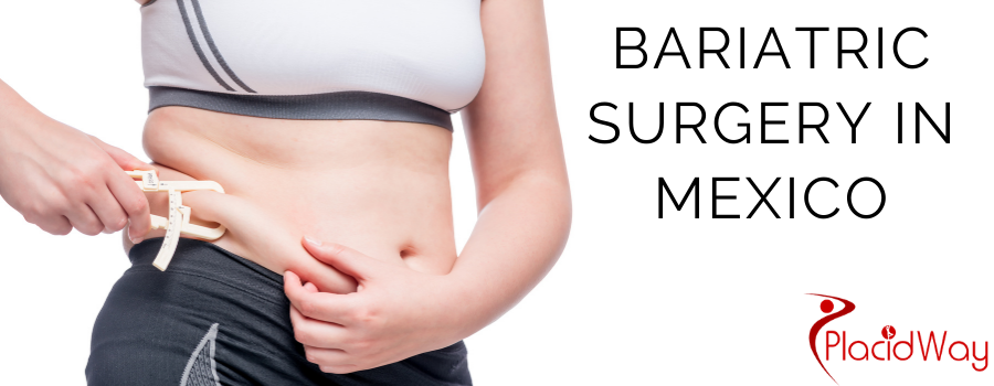 Bariatric Surgery in Mexico