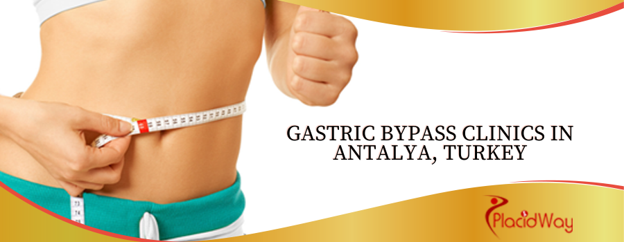 Gastric Bypass Clinics in Antalya, Turkey