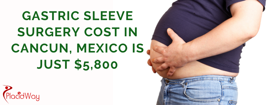 Gastric Sleeve Surgery Cost in Cancun, Mexico