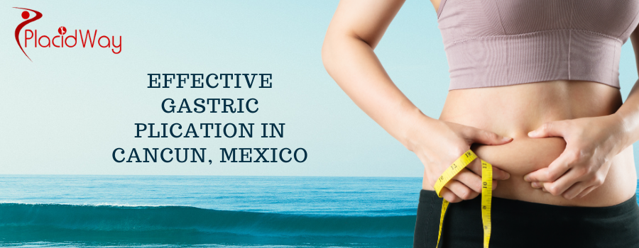 Effective Gastric Plication in Cancun