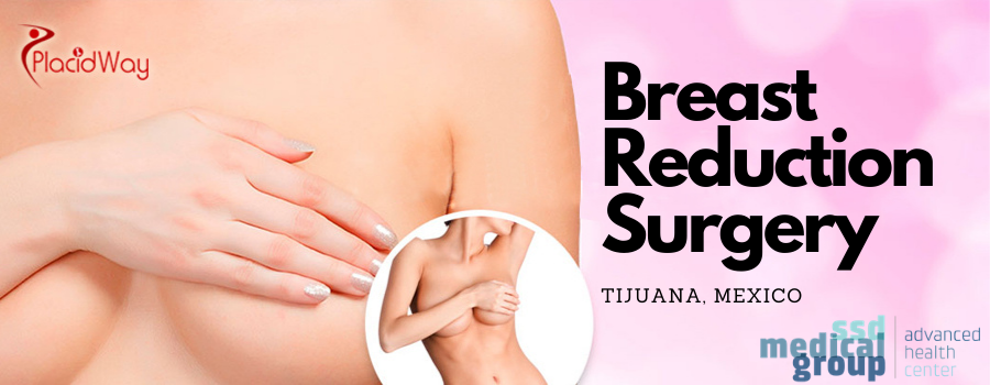 Breast Reduction Surgery in Tijuana, Mexico