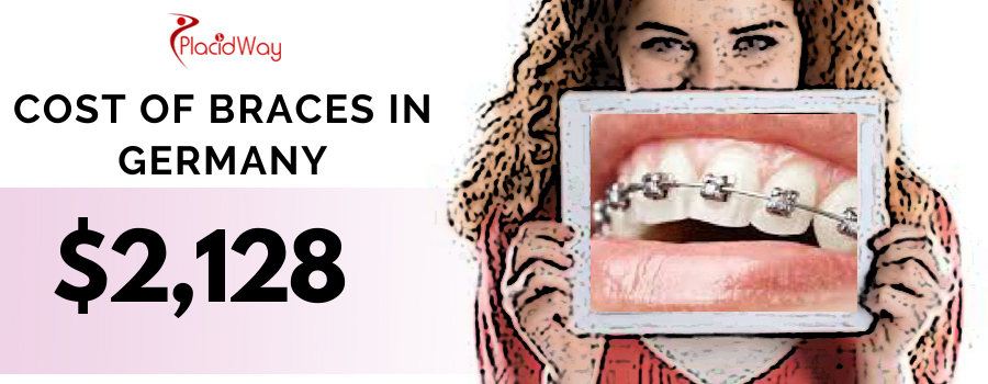 What is the cost of Braces in Berlin, Germany?