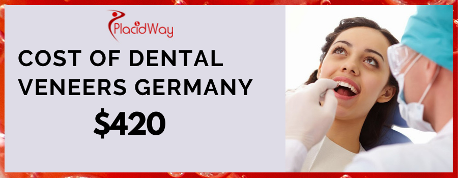 Cost Of Dental Veneers Germany