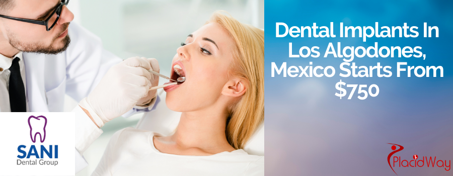 Best Dental Implants In Los Algodones At Sani Dental Group