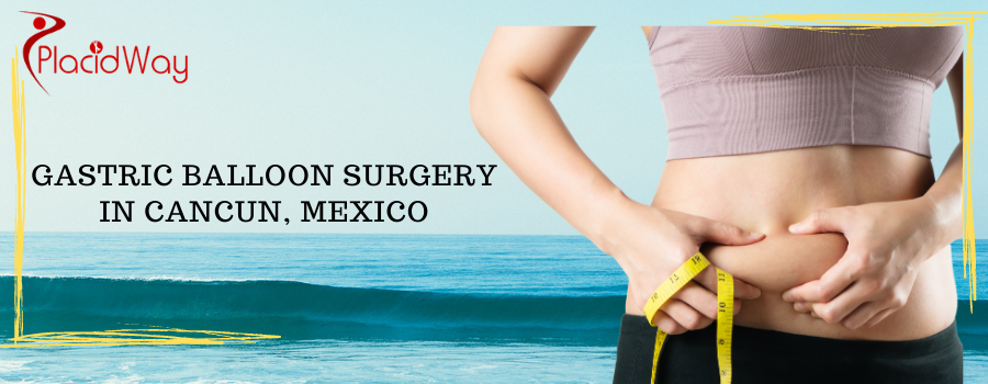 Gastric Balloon Cost in Cancun, Mexico