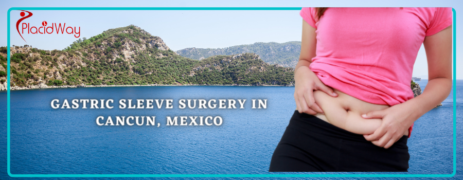 Gastric Sleeve Surgery in Cancun, Mexico
