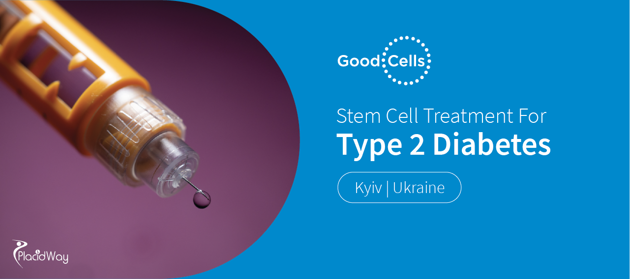 Stem Cell Treatment for Diabetes Type 2 Cost in Ukraine