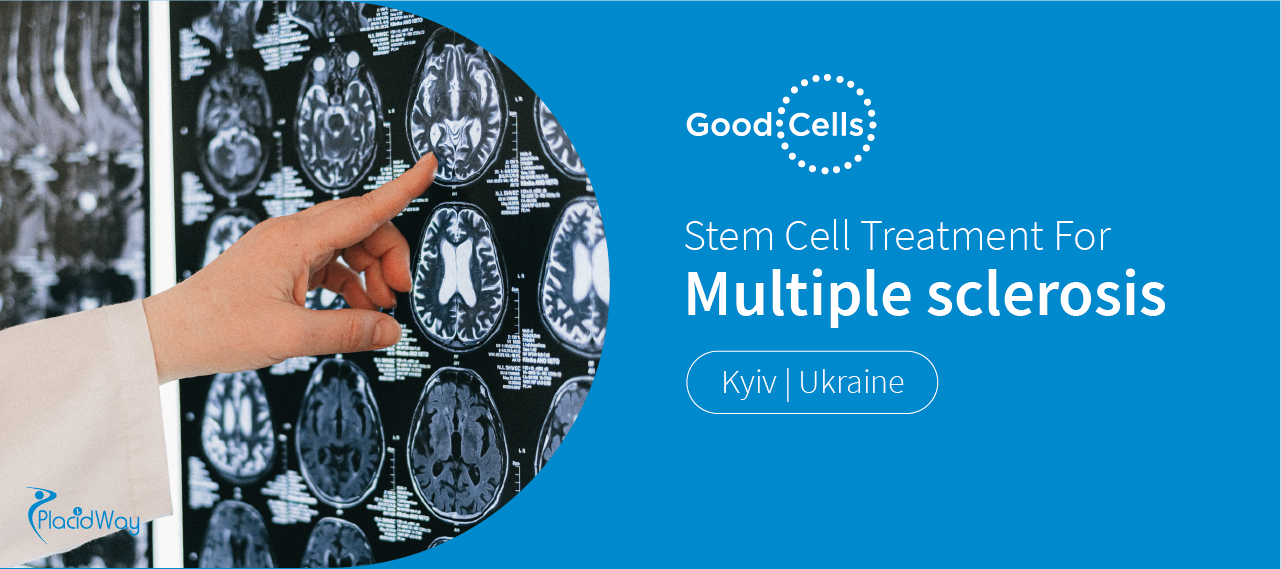 Stem Cell Therapy for Multiple Sclerosis