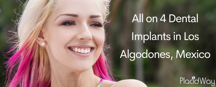 Dental Implants in Los Algodones Mexico