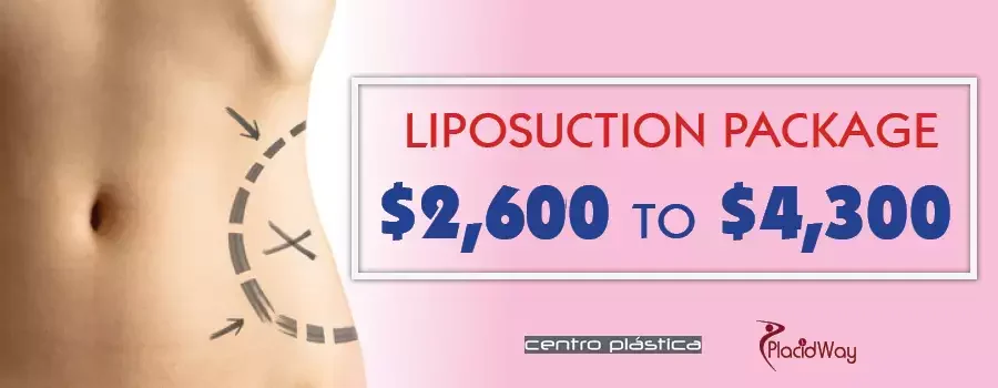 Liposuction Cost in Guadalajara, Mexico