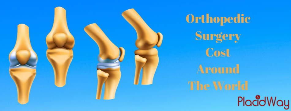 Orthopedic Surgery Prices World Wide