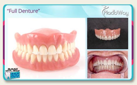 Full Porcelain or Acrylic Dentures in Los Algodones Mexico