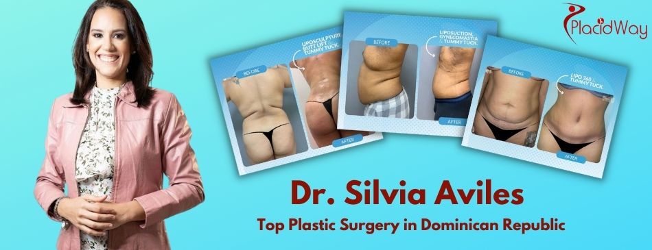 Best Plastic Surgeon in Santo Domingo, Dominican Republic