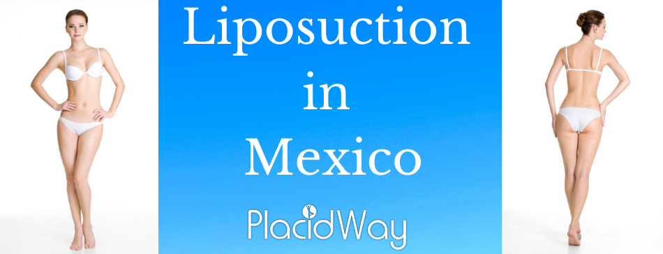 Liposuction in Mexico