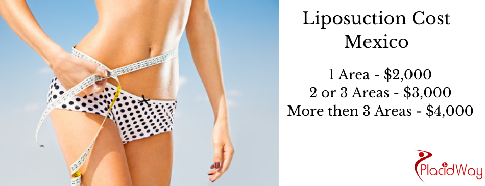 Liposuction Cost in Mexico