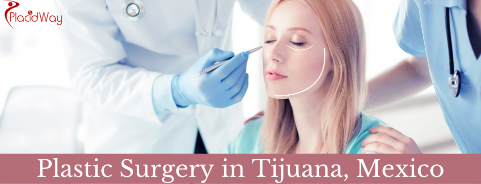 Tijuana, Mexico Plastic Surgery Packages