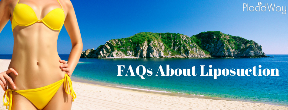 FAQs about Liposuction