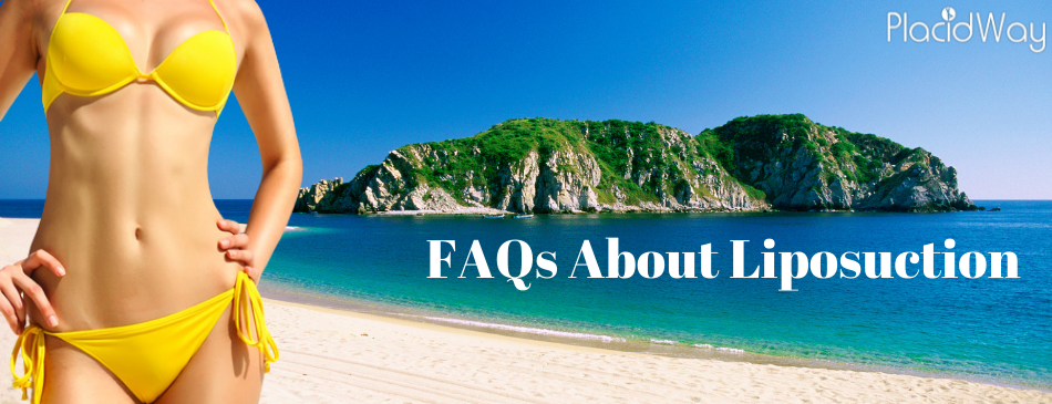 Frequently Asked Questions About Liposuction