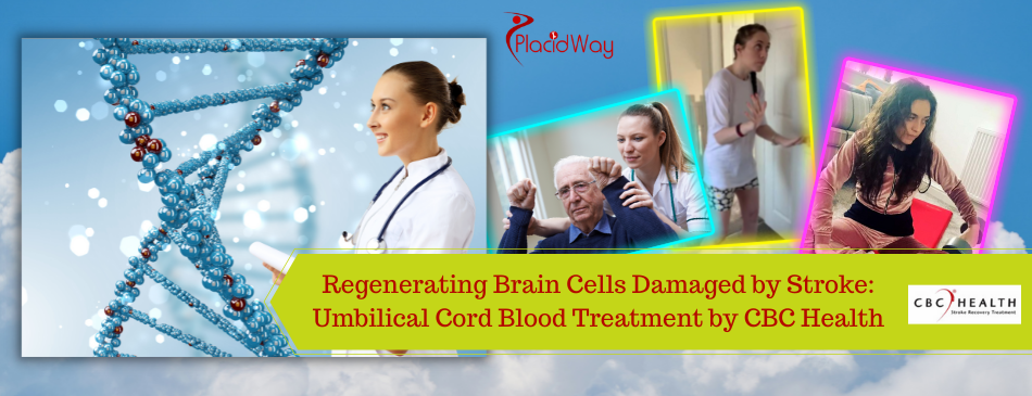 Regenerating Brain Cells Damaged: Stem Cell Therapy for Stroke