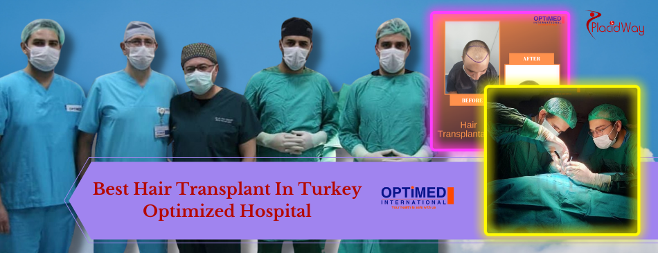 Best Hair Transplant In Turkey by Optimed Hospital 