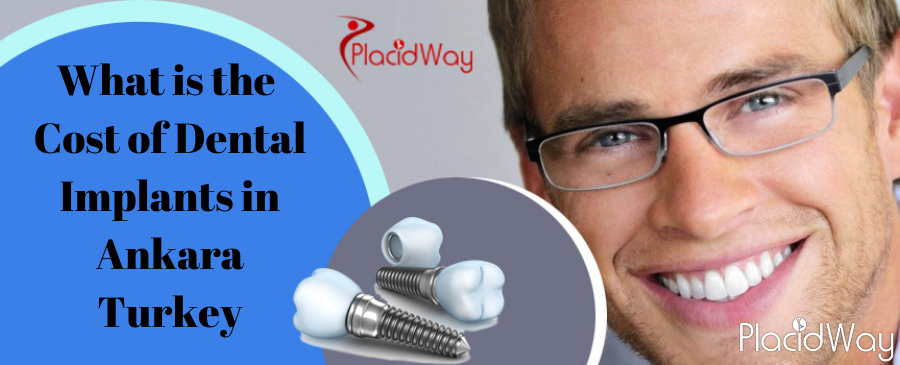 Cost of Dental Implants in Ankara, Turkey