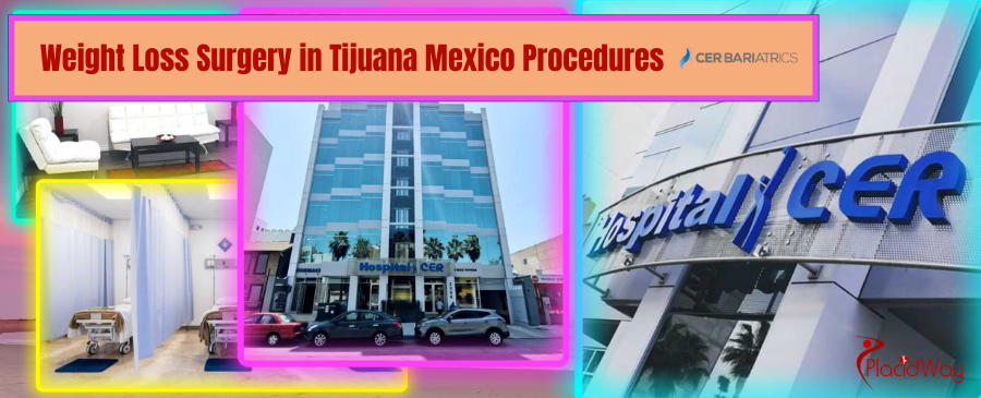 Weight Loss Surgery in Tijuana Mexico by CER Bariatrics