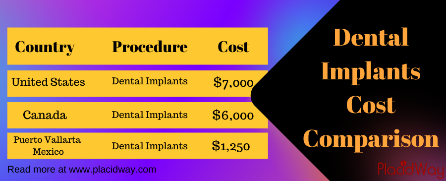 Dental Implants Cost Comparison