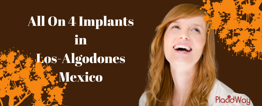 All on 4 Implants in los algodones