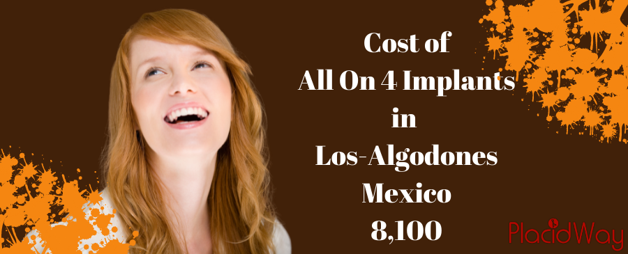 Cost of dental implants in mexico