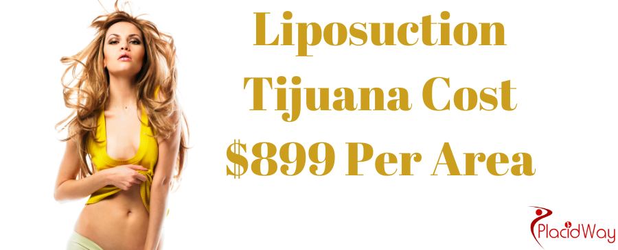 Liposuction Cost in Tijuana, Mexico