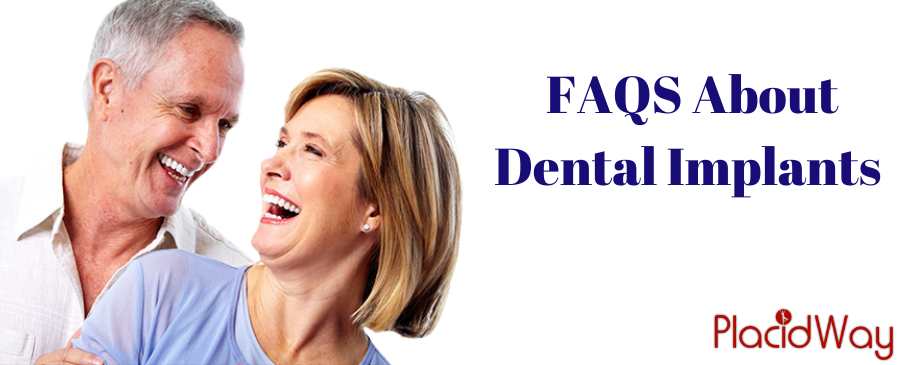 FAQS About Dental Implants in Turkey