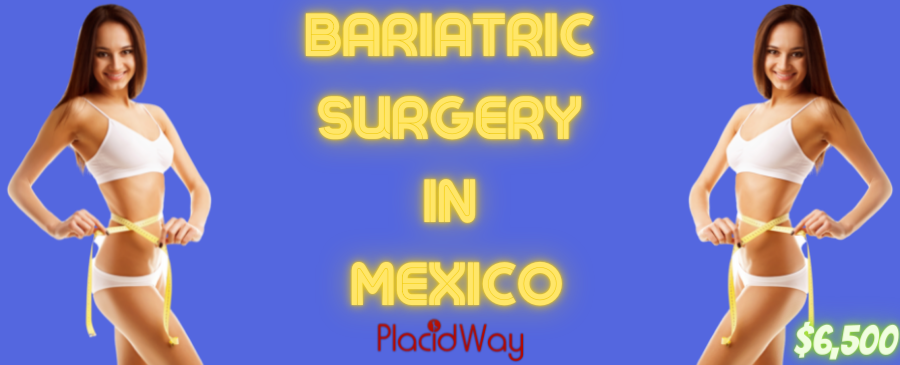 Bariatric/Weight-loss Surgery in Mexico