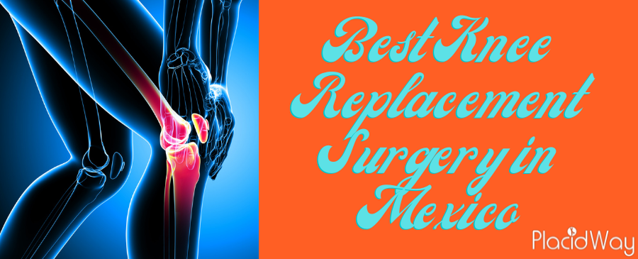 knee replacement surgery in Mexico