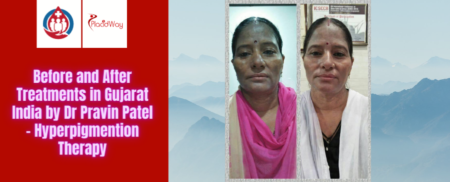 Before and After Stem Cell Treatments in Gujarat, India